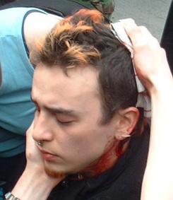 Injured RTS protester